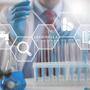legionella vizsgalat legionella vizsgalat