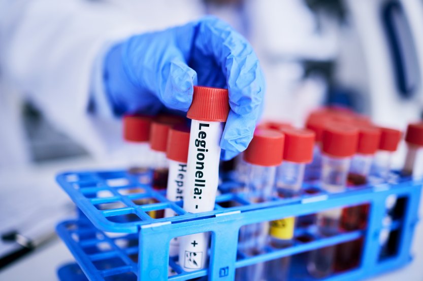 legionella vizsgálat
